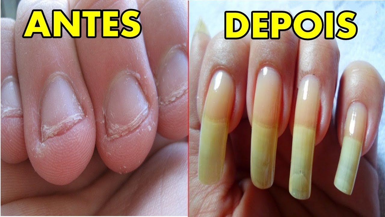 COMO FAZER A UNHA CRESCER COM GUA EM 5 MIN L SOARES Doovi