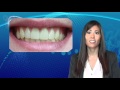 Teeth Whitening Options - Cosmetic Dental Associates San Antonio, TX