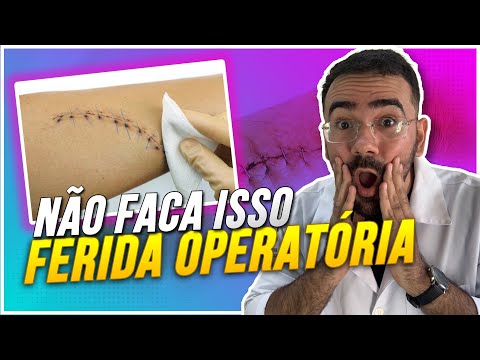 Vídeo: Como cuidar de uma ferida após a remoção dos pontos