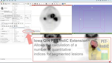 Positron Emission Tomography (PET) quantification using 3D Slicer