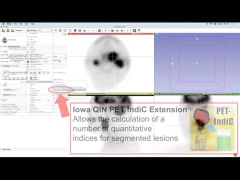 Positron Emission Tomography