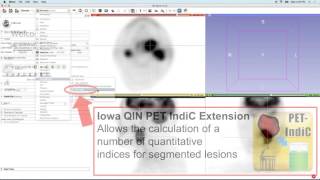 Positron Emission Tomography (PET) quantification using 3D Slicer