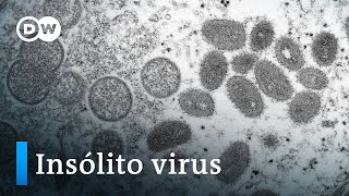 Caracteristicas de la viruela
