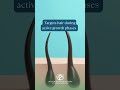 Tired of the constant shave–wax–repeat cycle?