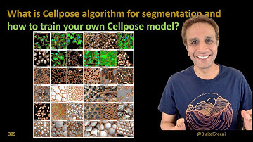 305 - What is Cellpose algorithm for segmentation?