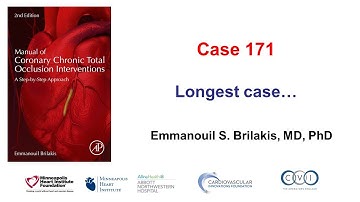 Case 171: Manual of CTO PCI - Longest case