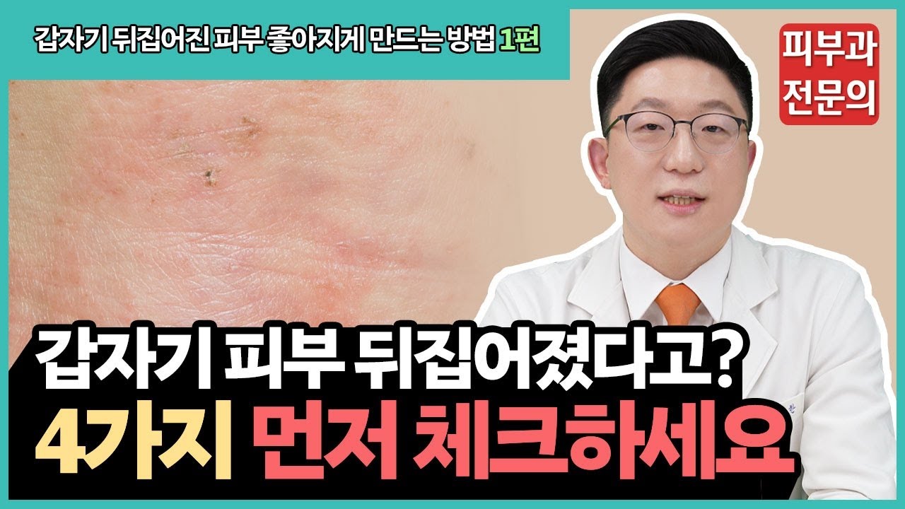 중요한 약속 앞두고 갑자기 피부가 뒤집어지는 이유? (1편)