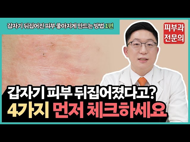중요한 약속 앞두고 갑자기 피부가 뒤집어지는 이유? (1편)