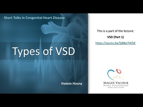 Video: Hypertensieve Type VSD-behandeling