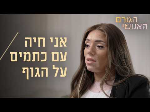הגורם האנושי | טריגר: פגיעה מינית 🚨צופיה הפכה את ההתמודדות עם הויטיליגו לעסק שעוזר לרפא את הגוף
