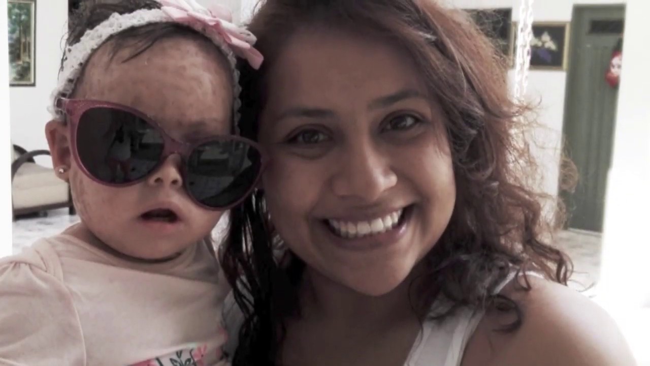 Una en un Millón, Ictiosis Lamelar - Teleantioquia