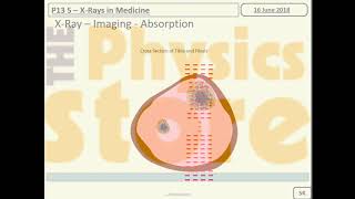 P13 5 X Rays in Medicine