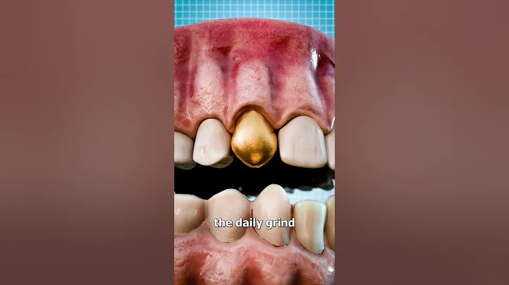 Why Dentists Still Use Gold Teeth 🤔 - DayDayNews