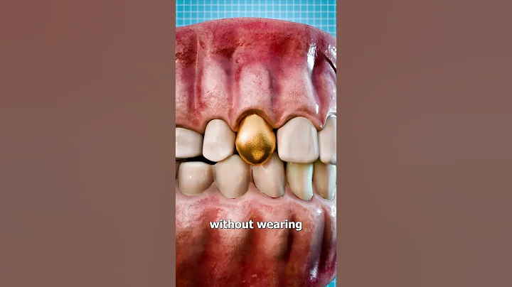 Why Dentists Still Use Gold Teeth 🤔 - DayDayNews