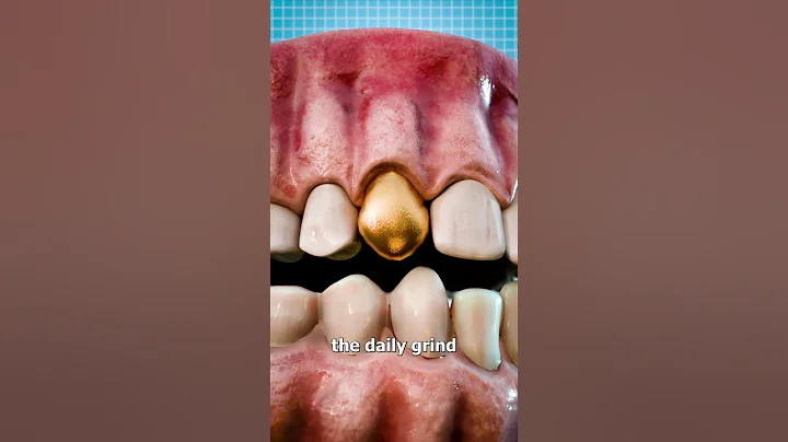 Why Dentists Still Use Gold Teeth 🤔 - DayDayNews