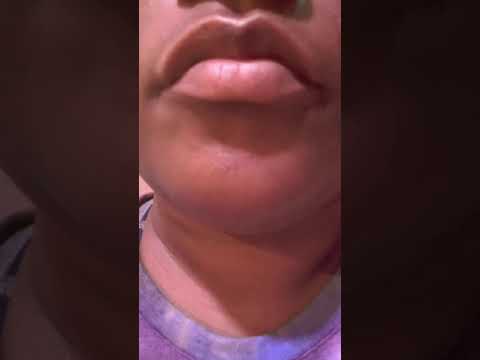 تکان خوردن لب شورت