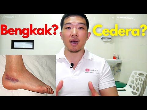 Cedera ? Bengkak ? Sembuhin sendiri yuk!