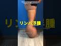 【人生終了…歩けません】 #shorts #雑学 #むくみ #リンパ浮腫 #science