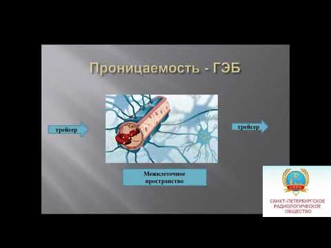 Гоголева С.С. «Методика МР-перфузии. Роль рентгенолаборанта»