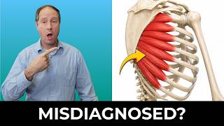The HIDDEN Shoulder Blade Weakness Behind Neck Pain, Cervicogenic Dizziness & Headaches: 4 FIXES
