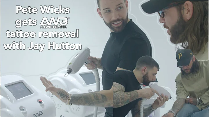 Jay Hutton & Pete Wicks- Allwhite Laser