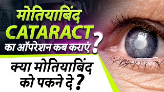 Cataract मतयबद क ऑपरशन कब करए When Is Cataract Surgery Necessary?