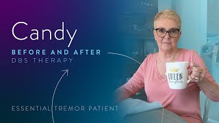 Essential Tremor Symptoms Stimulation Off vs. On with Candy