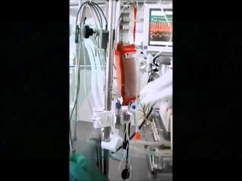 Standard Geschlossenes Drucksystem