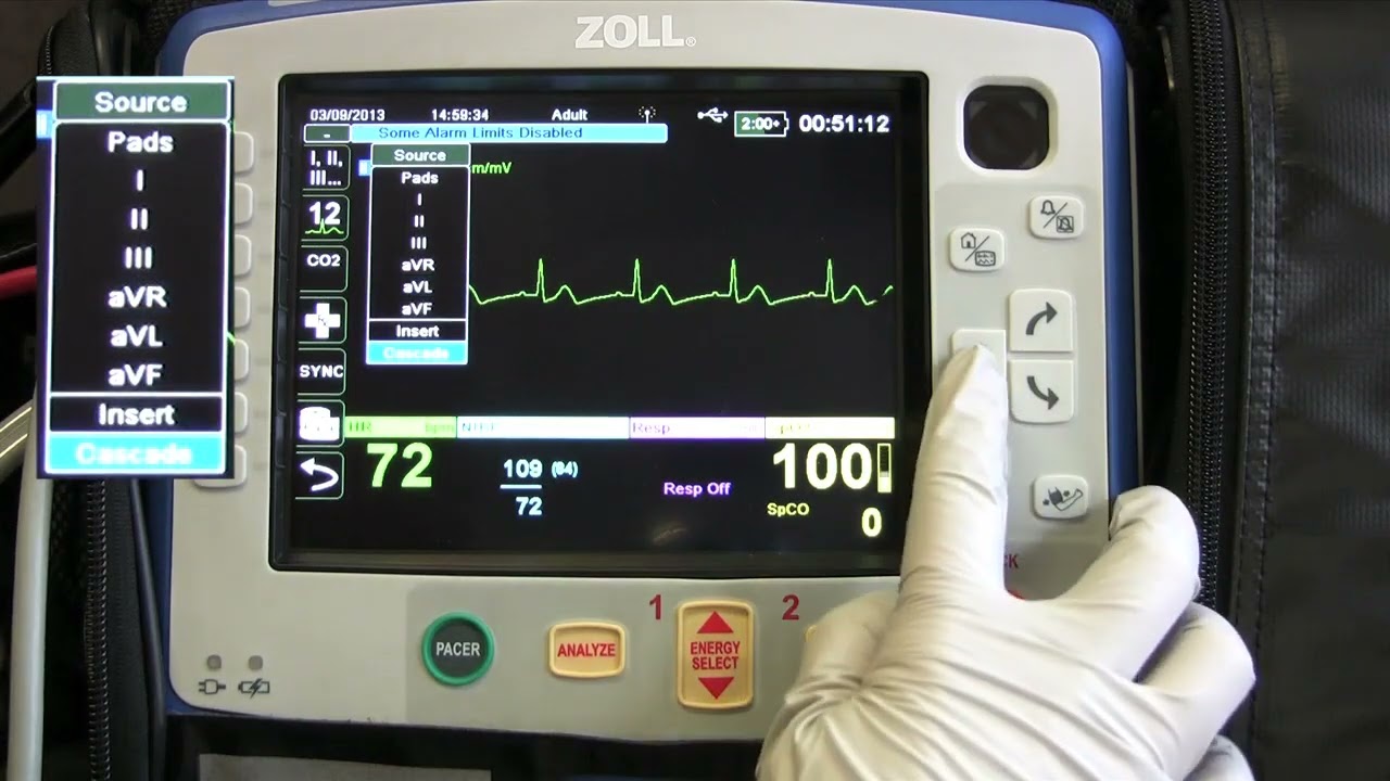 Instruction of the Zoll X Series   Part 3 Basic EKG Monitoring