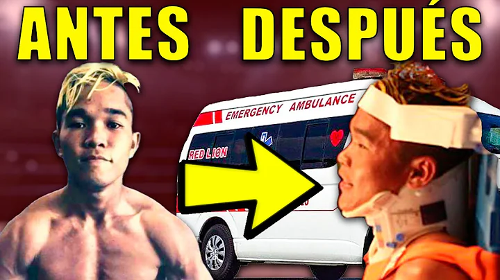 Llam Bulto a un Peleador Mexicano y Le Cost Su Car...