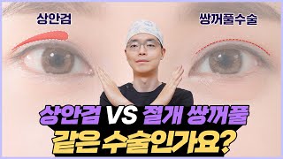 비슷한듯 다른 두 수술!상안검 VS 절개 쌍꺼풀 │상안검과 쌍꺼풀 Q&A✨