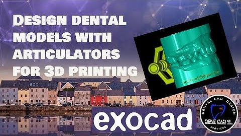 exocad 3d print model with articulator