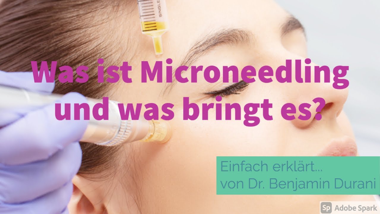 Microneedling - Einfach erklärt von Dr. Durani (Facharzt für Hautkrankheiten)