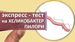 Тест на Хеликобактер пилори. 🔬 Как делают уреазный экспресс - тест на Хеликобактер пилори?