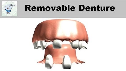 Removable Partial Denture Animation