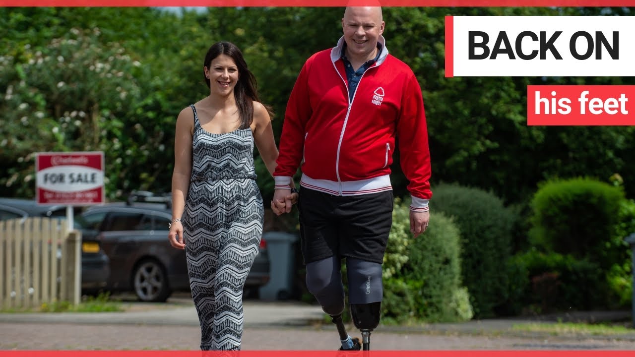 health insurance Diabetic football fan who struggled to walk is back on his feet after having legs amputated