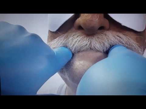 Russell Klein Dentures: The Before & After Photos Will Leave You Speechless