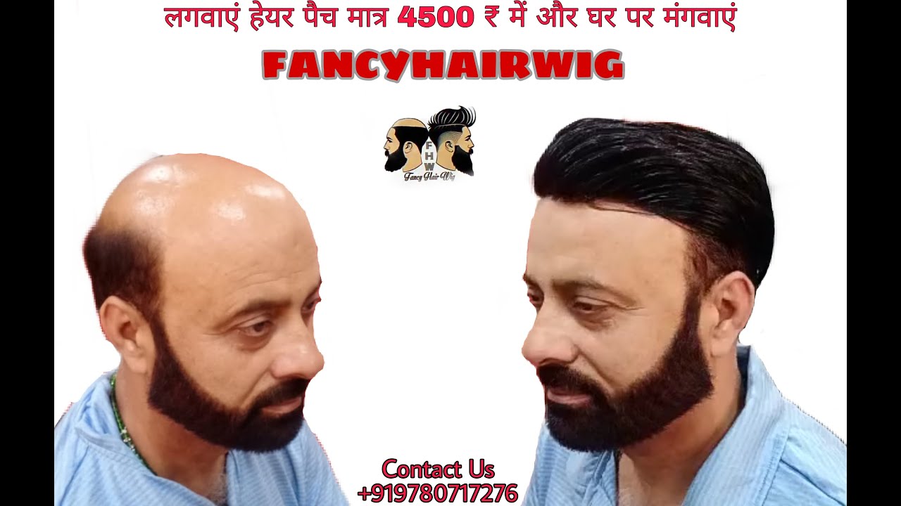 Hair Patch & Wig and Service in Pathankot, Jalandhar, Patiala