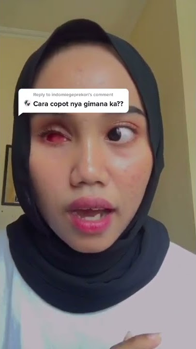 wanita dengan mata palsu tetap bersyukur