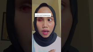 wanita dengan mata palsu tetap bersyukur screenshot 3