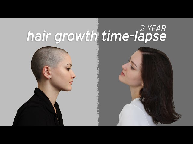 Hair Growth Time-lapse - 2 Years class=