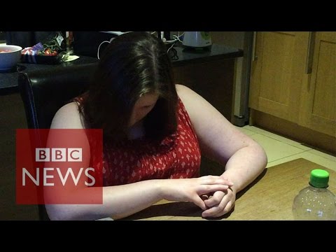 Narcolepsy: What is it like to have a cataplexy attack - BBC News