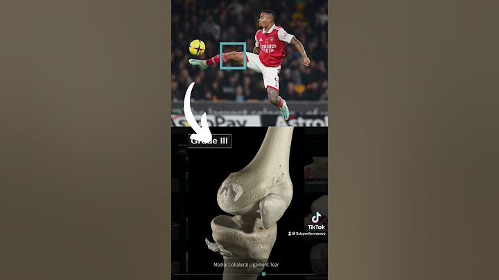 Gabriel Jesus Knee Injury Explained | #arsenal #arsenalfc #afc #epl #premierleague #footballnews