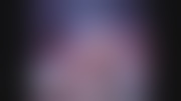 Robot left hemi-hepatectomy with hilar lymph node dissection