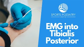 Indwelling EMG into Tibialis Posterior