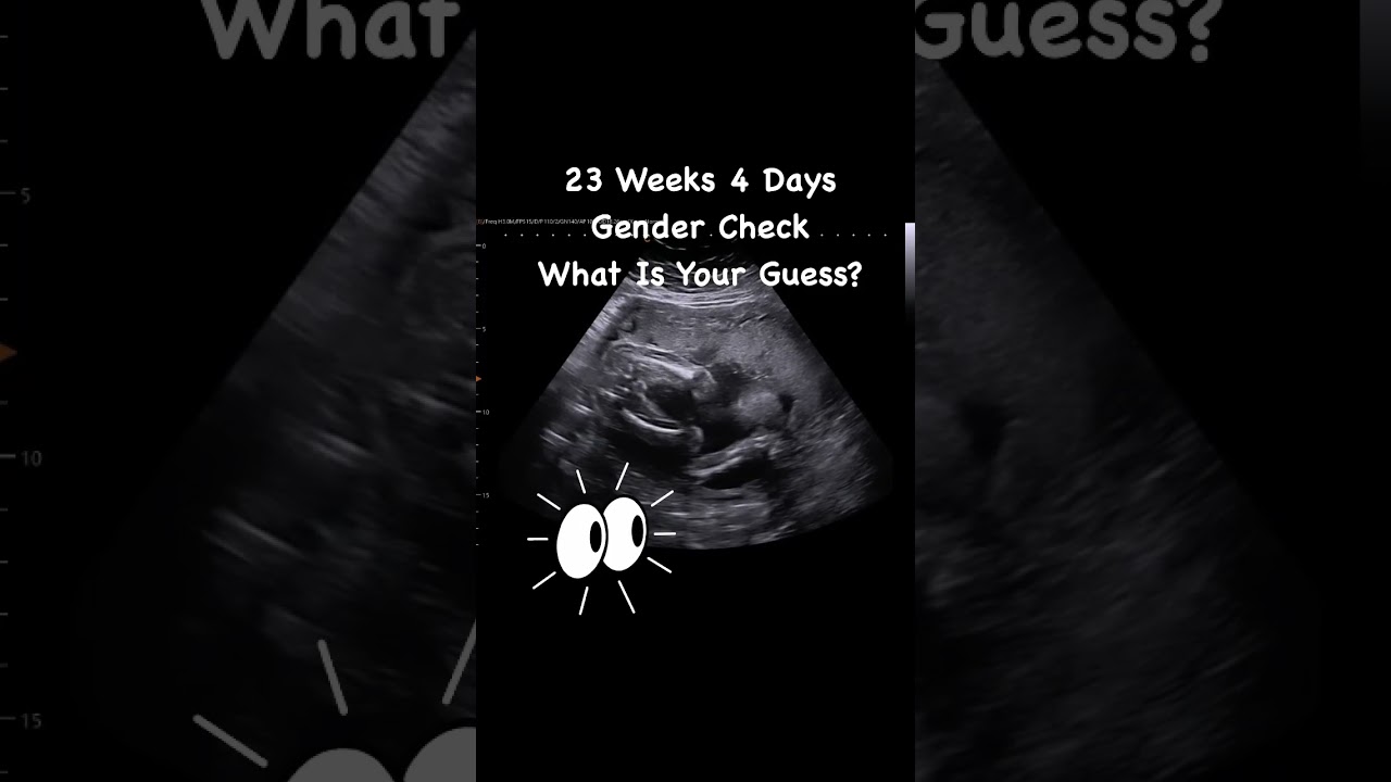 23 Weeks 4 Days Gender Check 