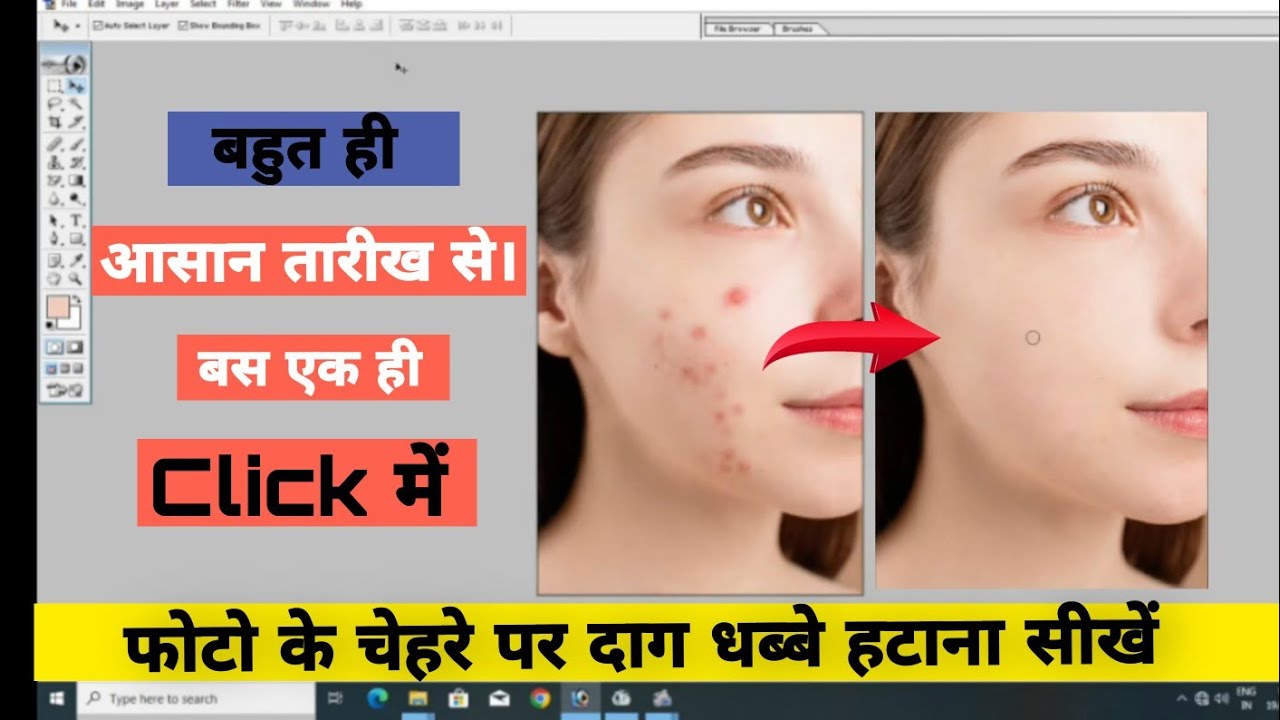 Photoshop Pimples Dark Spots Remove Hindi How photoshop-pimples-dark-spots-remove-hindi-how