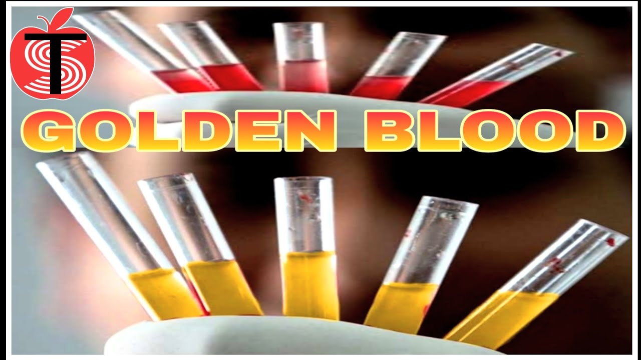 Golden Blood Rh null golden-blood-rh-null
