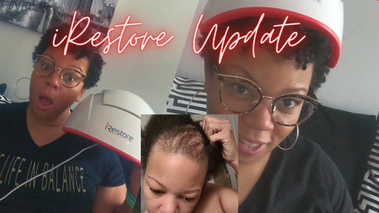 iRestore Update/ CCCA Hair Loss Solutions