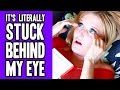 11 Struggles For People With Contact Lenses